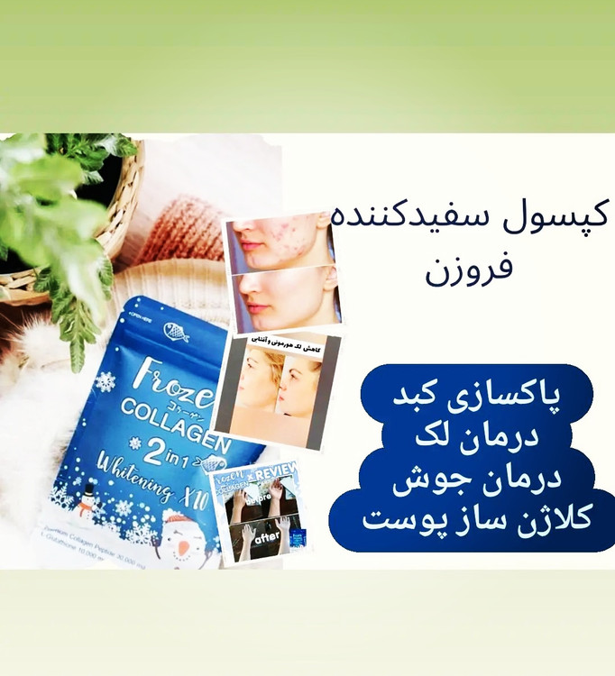 خرید و قیمت مکمل سفیدکننده قوی فروزن منجمد اصل و اورجینال