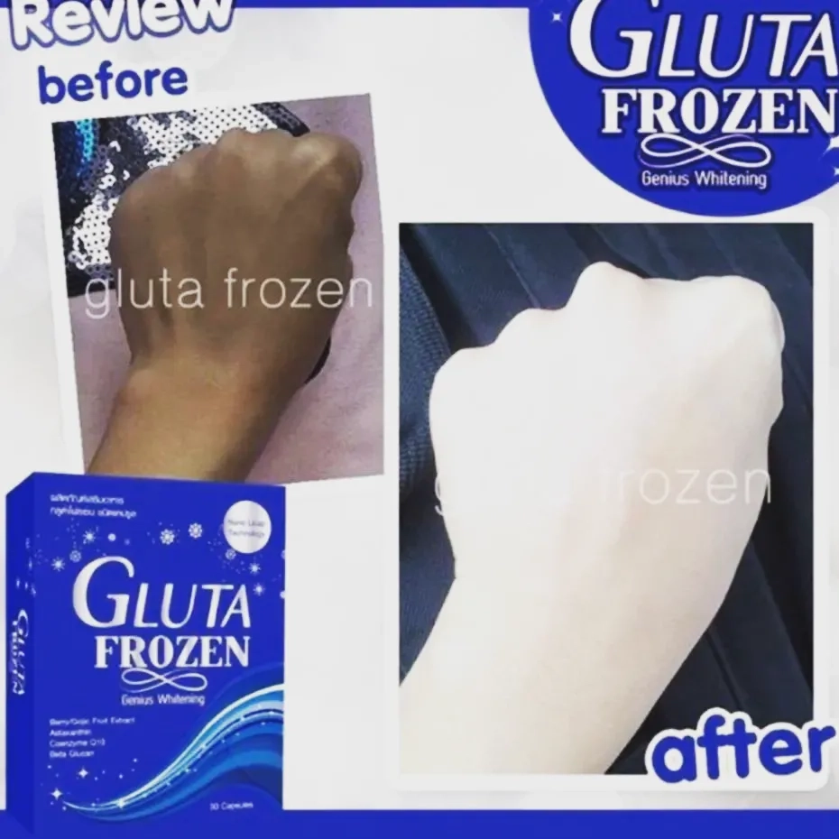خرید و قیمت مکمل سفیدکننده قوی پوست صورت و بدن گلوتافروزن اصل