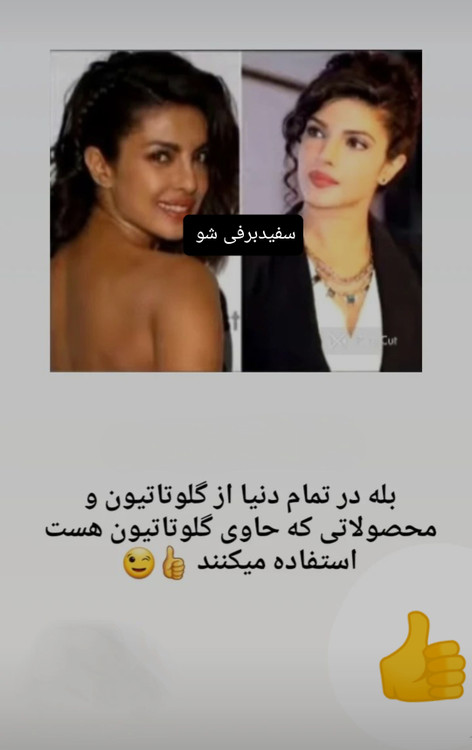 سفارش اینترنتی گلوتاوایت یا مکمل سفیدکننده سوپرگلوتا