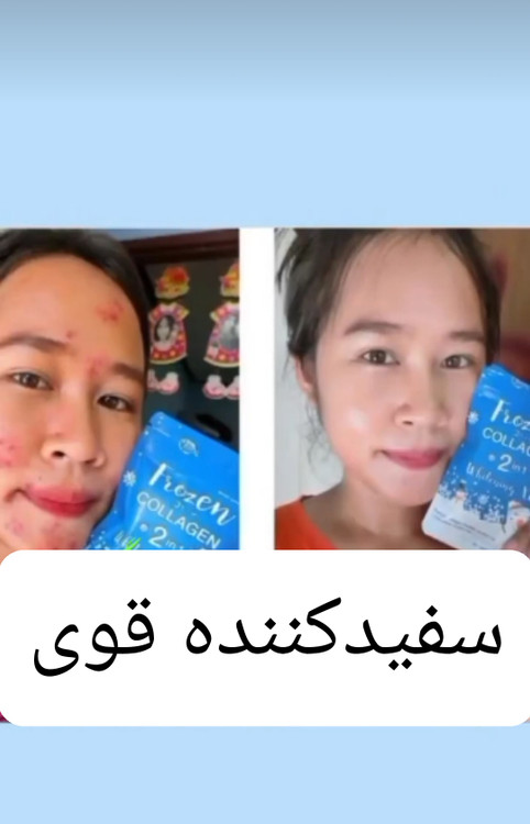 خرید و قیمت قرص لزل و فروزن منجمد اصل تایلند و درجه یک ارجینال