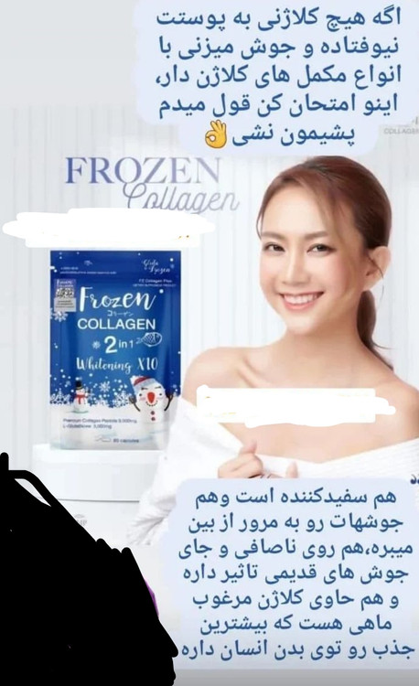 مکمل روشن کننده قوی پوست فروزن منجمد ضدجوش و سفیدکننده و ضدچروک