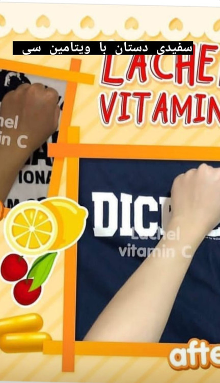 پکیج سفیدکننده کل صورت و بدن لزل و فروزن منجمد و ویتامین سی