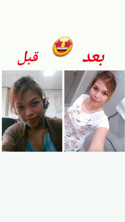 نتیجه استفاده از قرص سفیدکننده بسیار قوی کل صورت و بدن دوز نودهزار آمریکایی