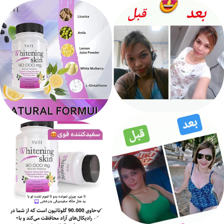 خرید و قیمت قرص روشن کننده پوست، قرص ضدلک قوی پوست صورت و بدن