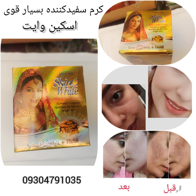 خرید و قیمت کرم سفیدکننده بسیار قوی اسکین وایت درجه یک و ارجینال و اصله اصل