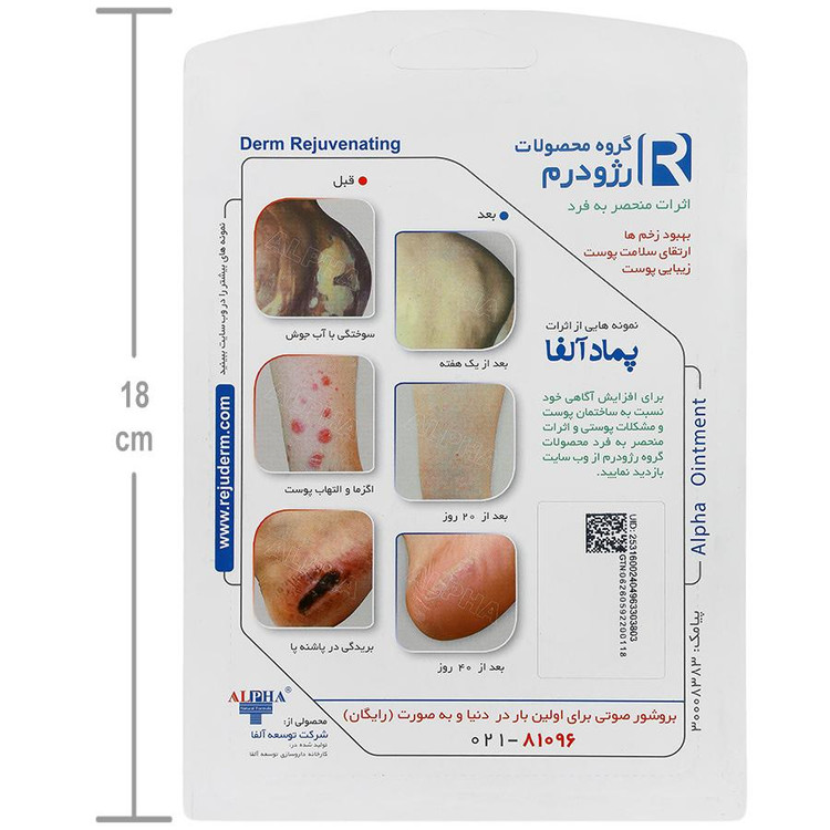 خرید اینترنتی پماد آلفا مخصوص سوختگی و برطرف کردن زخم ناشی از جراحی و سوختگی