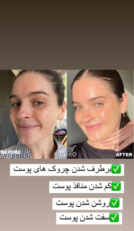 خرید سرم کلارنس اصلی و تضمینی و اورجینال و اصله اصل