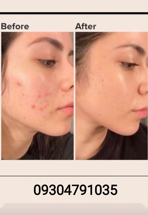 سفارش اینترنتی خرید سرم ضد لک اکسیس وای AXIS-Y اصلاح لکه های پوستی Dark Spot Glow Serum