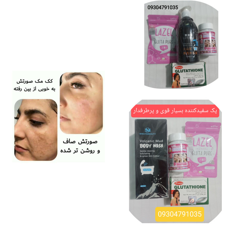 خرید و قیمت پک سفیدکننده بسیار قوی(لزل، سوپرگلوتا، شامپوی سفیدکننده مجیک، صابون سفیدکننده گلوتاتیون خالص)