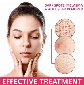 قیمت و خرید سفیدکننده بسیار قوی و پرطرفدار اسکین وایتنینگ اصل و درجه یک جواب دهی عالی