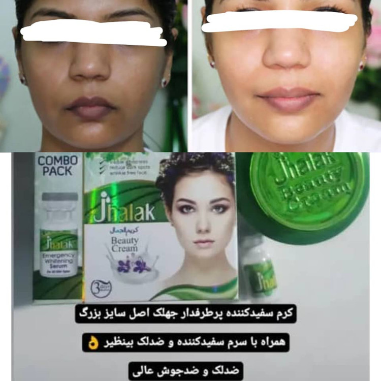 قیمت و خرید کرم سفیدکننده پرطرفدار و محبوب جهلک سبز همراه با سرم کاملاً اصل و تضمینی