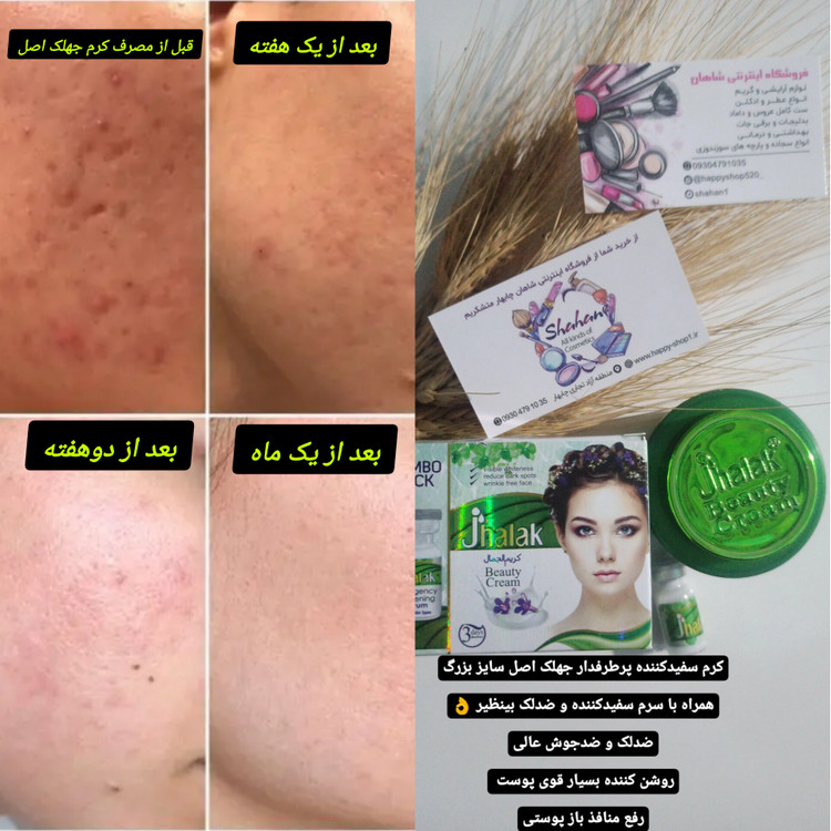 سفارش اینترنتی کرم سفیدکننده پرطرفدار و محبوب جهلک سبز همراه با سرم کاملاً اصل و تضمینی